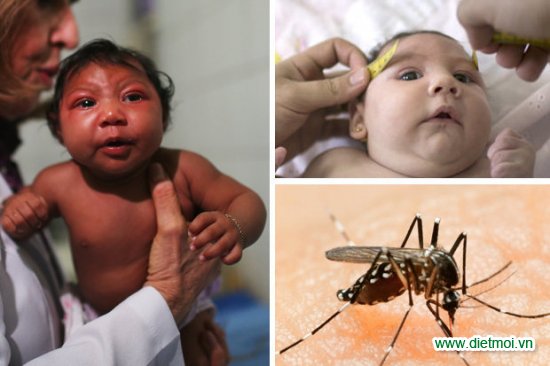 Virus Zika căn bệnh nguy hiểm do muỗi gây ra.